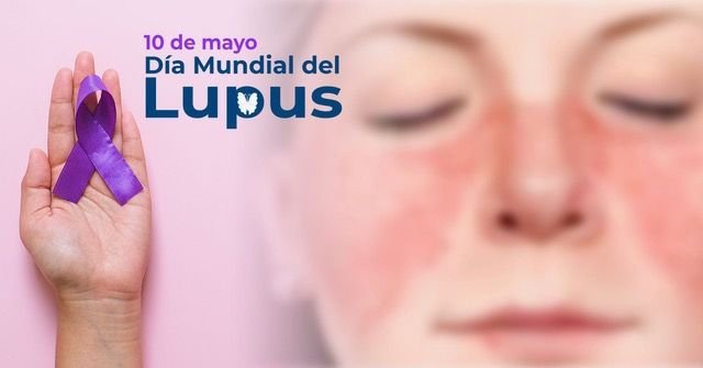 dia mundial del lupus
