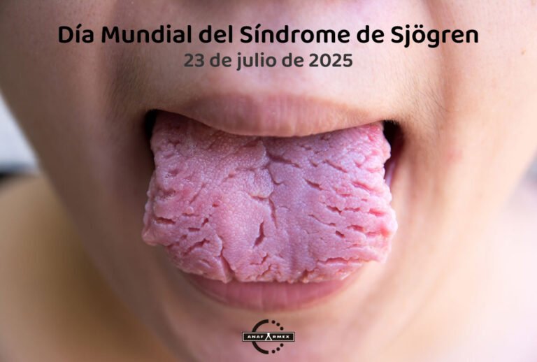 Día Mundial del Síndrome de Sjögren