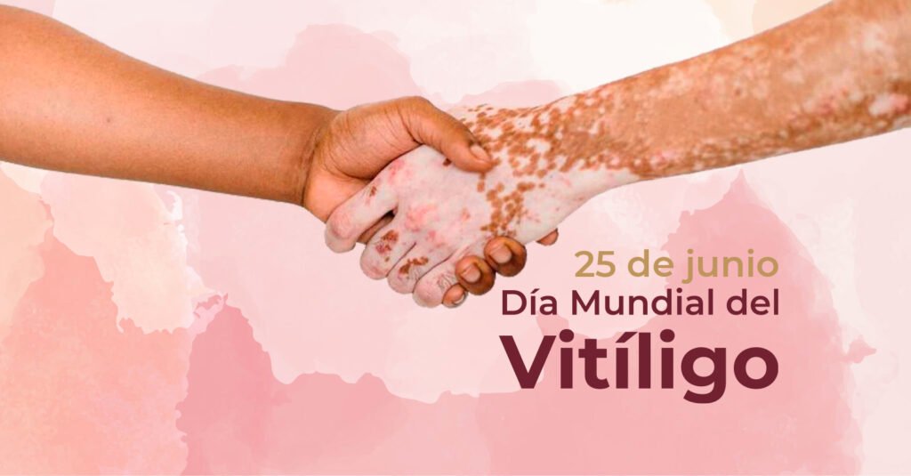 Día Mundial del Vitíligo
