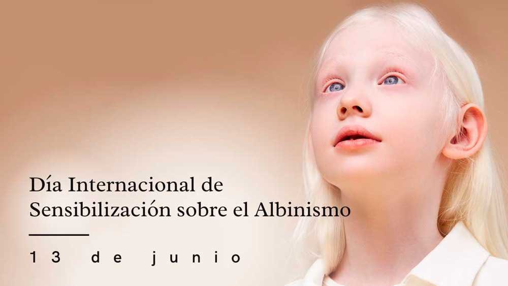 Día Internacional de la Sensibilización sobre el Albinismo